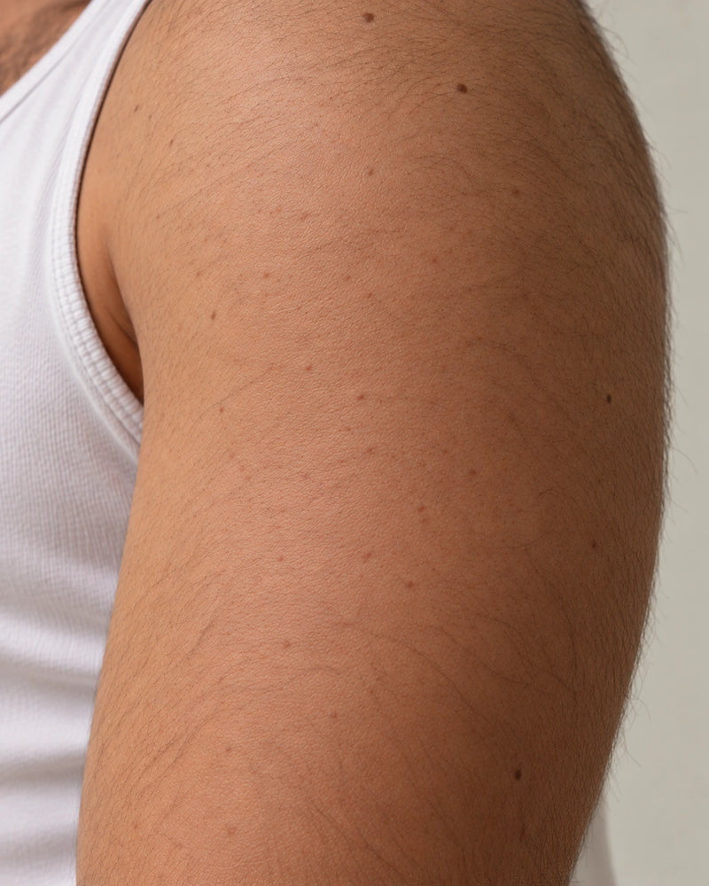 After 8 weeks: the same upper arm with a more even-looking surface while pores, hair and minor bumps remain visible.
