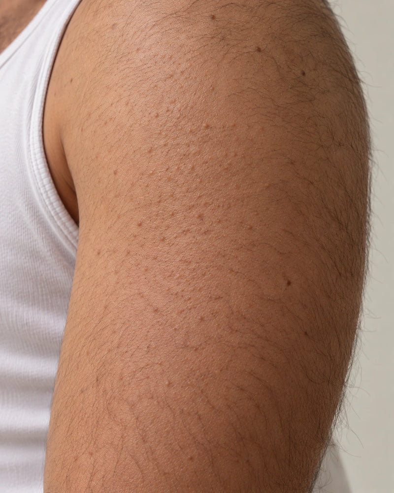Before: close-up of an illustrative male model's upper arm showing dry, uneven and visibly rough follicular texture.