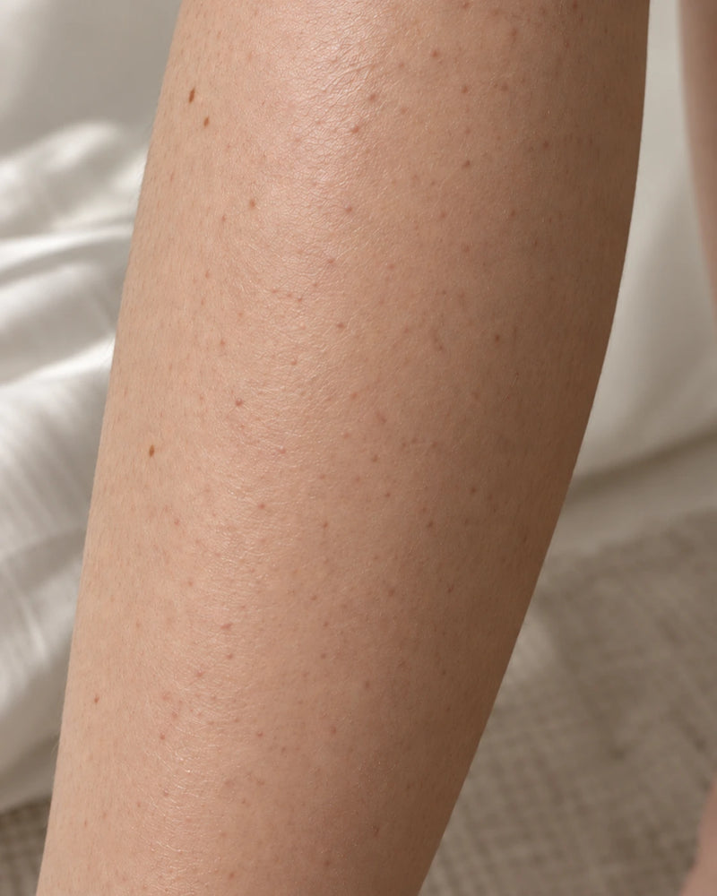 After6 weeks: the same shin appearing softer and more hydrated with natural textureand follicles still visible.