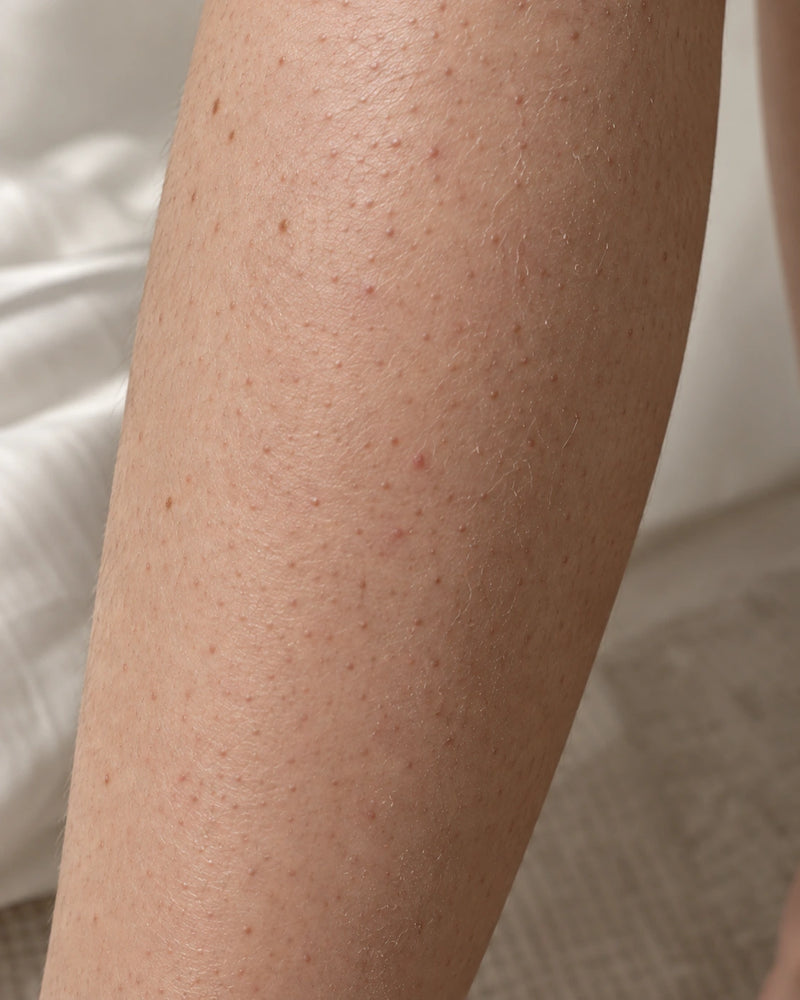 Before:close-up of an illustrative model's shin showing dry, dull skin and fine roughfollicular texture.
