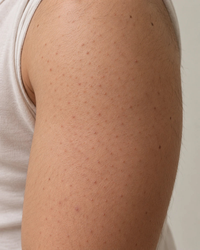 Before: close-up of an illustrative male model's upper arm with fine body hair and mild raised follicular texture.
