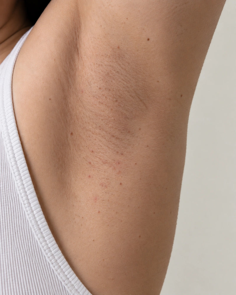 After 8 weeks: the same underarm appearing calmer and more balanced while natural folds, pores and pigmentation remain visible.