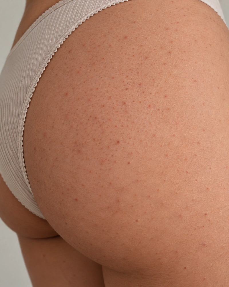 Before: close-up of an adult illustrative model's buttock showing scattered follicular bumps and visibly uneven skin texture.