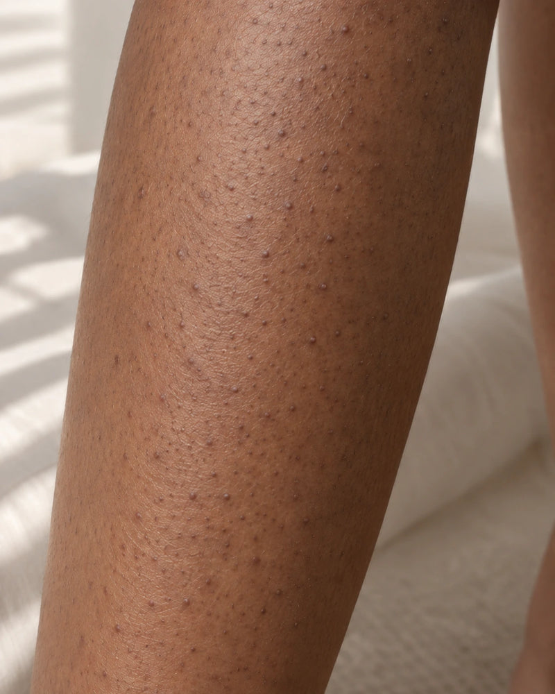 Before: close-up of an illustrative model's leg showing pronounced follicular dots,small bumps and uneven-looking texture on deeper skin.