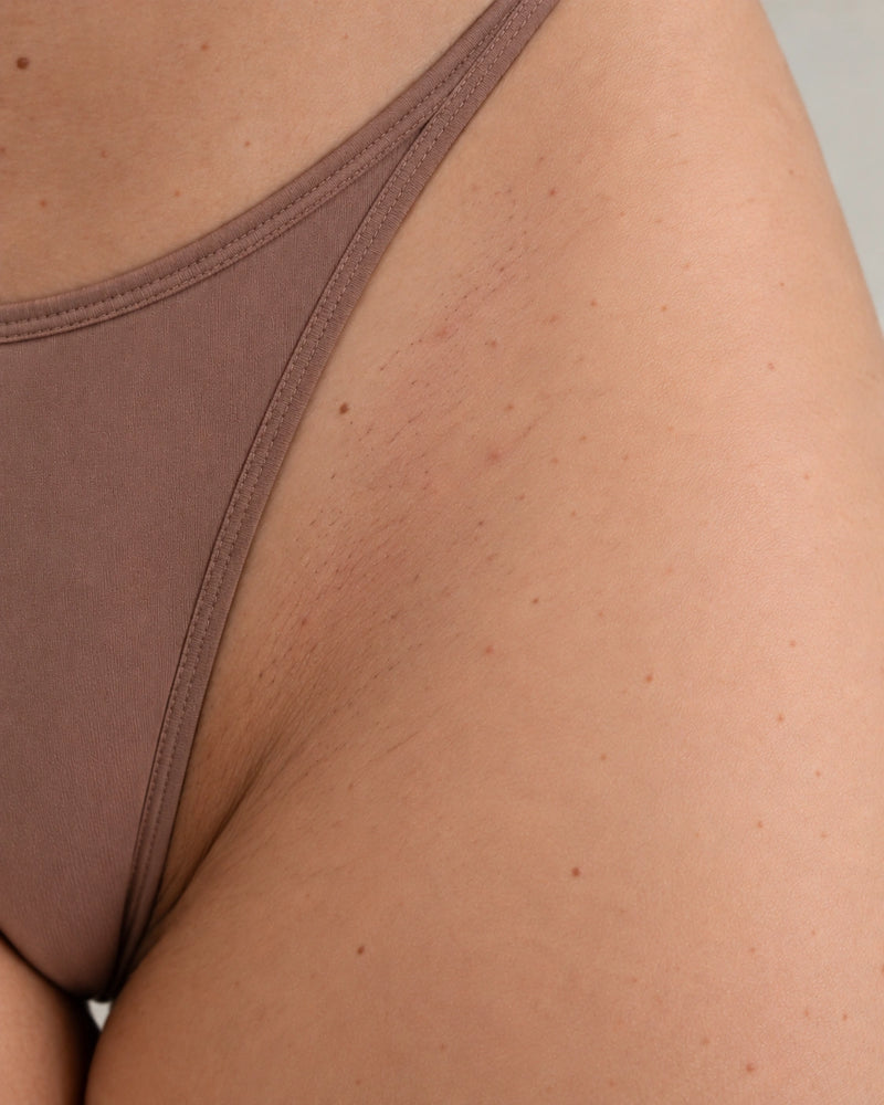 After 8 weeks: the same bikini-line skin appearing calmer and more balanced with natural follicles and colour variation preserved.